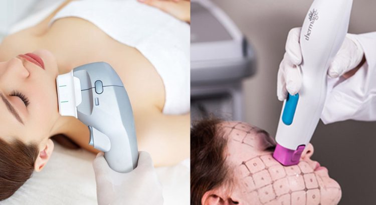 Thermage và HIFU - sự kết hợp toàn diện trong liệu trình trẻ hóa da