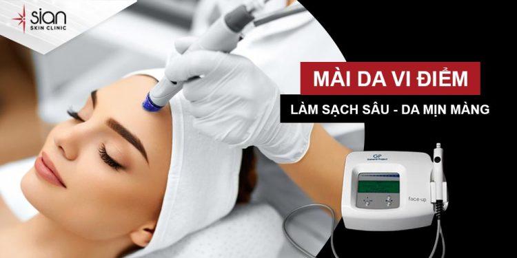 Liệu trình mài da vi điểm ( microdermabrasion ) sử dụng công nghệ tiên tiến GP Face-up