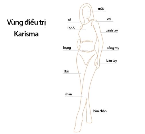 Các vùng Karisma điều trị hiệu quả